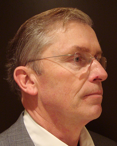 male facelift patient