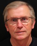 male facelift patient