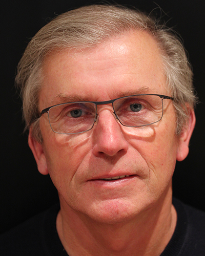 male facelift patient